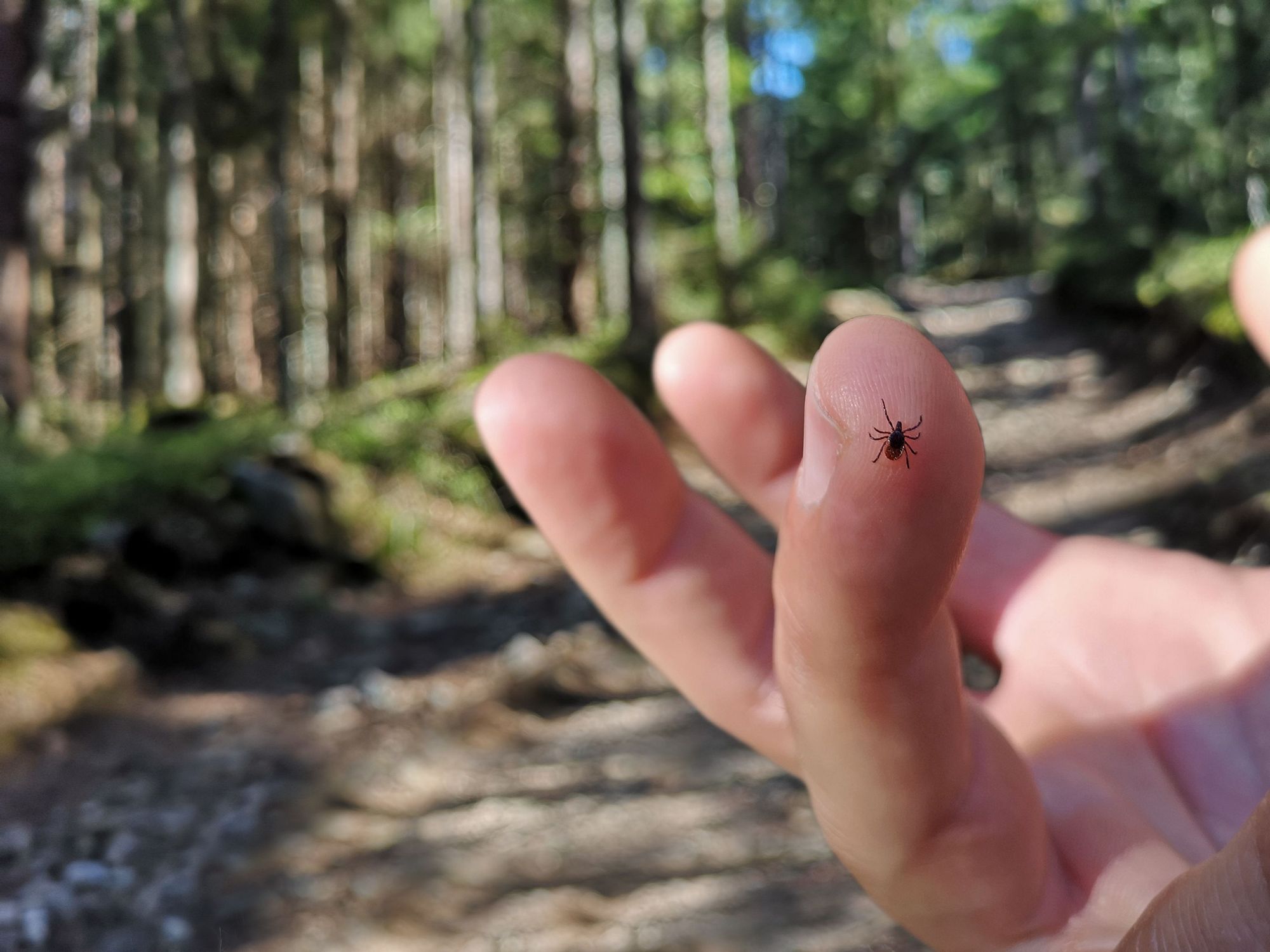 How to Remove a Tick Properly (and Avoid Ticks to Start With)